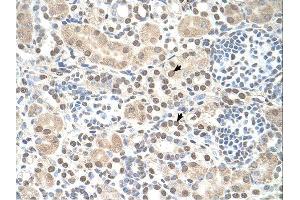 ST8SIA2 antibody was used for immunohistochemistry at a concentration of 4-8 ug/ml. (ST8SIA2 抗体  (C-Term))