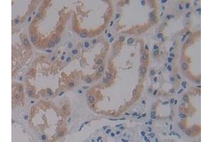 Detection of CRY1 in Human Kidney Tissue using Polyclonal Antibody to Cryptochrome 1 (CRY1) (CRY1 抗体  (AA 3-132))