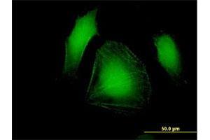 Immunofluorescence of purified MaxPab antibody to LDB3 on HeLa cell. (LIM Domain Binding 3 Protein 抗体  (AA 1-283))