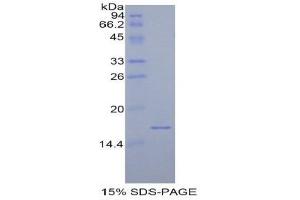 SDS-PAGE (SDS) image for Calcitonin-Related Polypeptide alpha (CALCA) (AA 1-134) protein (His tag) (ABIN1821632)