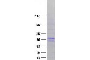 Western Blotting (WB) image for Muscleblind-Like Splicing Regulator 3 (MBNL3) (Transcript Variant 4) protein (Myc-DYKDDDDK Tag) (ABIN2725588)