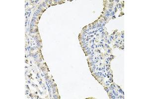 Immunohistochemistry (IHC) image for anti-Sodium Channel, Nonvoltage-Gated 1, gamma (SCNN1G) (AA 85-355) antibody (ABIN6147453)