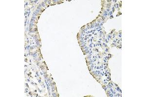 Immunohistochemistry of paraffin-embedded mouse lung using SCNN1G antibody (ABIN6129468, ABIN6147453, ABIN6147454 and ABIN6221724) at dilution of 1:100 (40x lens). (SCNN1G 抗体  (AA 85-355))