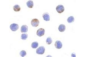 Immunofluorescence (IF) image for anti-DEAD (Asp-Glu-Ala-Asp) Box Polypeptide 3, X-Linked (DDX3X) (N-Term) antibody (ABIN499728)
