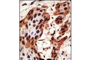 Immunohistochemistry (IHC) image for anti-Gap Junction Protein, beta 6, 30kDa (GJB6) (AA 87-117), (N-Term) antibody (ABIN5534072)