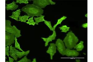 Immunofluorescence of purified MaxPab antibody to MPP5 on HeLa cell.