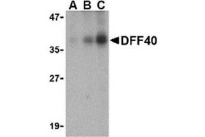 Western blot analysis of DFF40 in Jurkat cell lysate with AP30288PU-N DFF40 antibody at (A) 0. (DFFB 抗体  (Intermediate Domain))