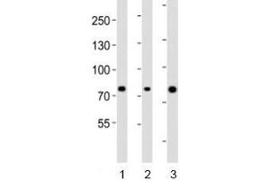 Western blot analysis of lysate from human 1) ovary, 2) placenta and 3) plasma lysate using Integrin beta 8 antibody diluted at 1:1000. (ITGB8 抗体  (AA 197-231))