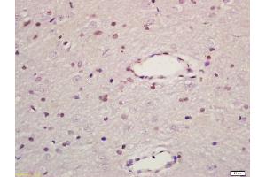 Formalin-fixed and paraffin embedded rat brain labeled with Anti-MAPK8IP1 Polyclonal Antibody, Unconjugated (ABIN716441) at 1:200 followed by conjugation to the secondary antibody and DAB staining (MAPK8IP1 抗体  (AA 425-524))