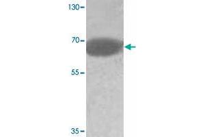 Western blot analysis of human fetal testis tissue lysate with ADAM20 polyclonal antibody  at 1:500 dilution. (ADAM20 抗体)