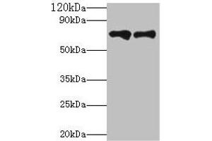 Western blot All lanes: Klkb1 antibody at 2 μg/mL Lane 1: Hela whole cell lysate Lane 2: Rat brain tissue Secondary Goat polyclonal to rabbit IgG at 1/10000 dilution Predicted band size: 72 kDa Observed band size: 72 kDa (KLKB1 抗体  (AA 391-638))