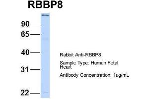 Host:  Rabbit  Target Name:  RBBP8  Sample Type:  Human Fetal Heart  Antibody Dilution:  1. (Retinoblastoma Binding Protein 8 抗体  (C-Term))