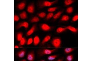 Immunofluorescence analysis of U2OS cells using ZEB1 Polyclonal Antibody (ZEB1 抗体)