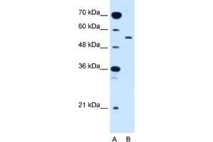Western Blotting (WB) image for anti-Solute Carrier Family 2 (Facilitated Glucose Transporter), Member 10 (SLC2A10) antibody (ABIN2462768) (SLC2A10 抗体)
