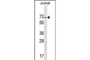 Western blot analysis in Jurkat cell line lysates (35ug/lane). (ZNF613 抗体  (C-Term))