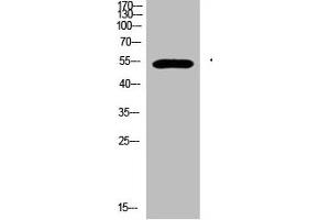 Western Blot analysis of 293T cells using primary antibody diluted at 1:500(4 °C overnight). (GCM2 抗体  (AA 21-70))