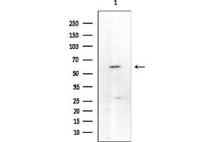 Western blot analysis of lysates from Mouse spleen, using PKM2 Mouse Monoclonal Antibody at 1/1000 dilution.