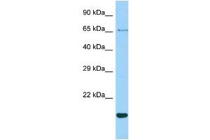 Host: Rabbit Target Name: CR1L Sample Type: ACHN Whole cell lysates Antibody Dilution: 1.