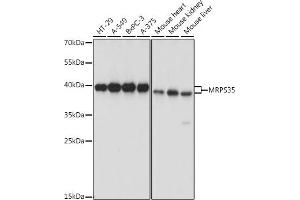 Western blot analysis of extracts of various cell lines, using MRPS35 antibody (ABIN7268587) at 1:1000 dilution. (MRPS35 抗体  (AA 1-323))