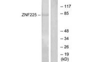 Western blot analysis of extracts from HeLa cells, using ZNF225 Antibody. (ZNF225 抗体  (AA 641-690))