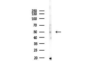 Western blot analysis of lysates from 293 cells(UV,30 min treatment), using IGSF21 Antibody at 1/1000 dilution.
