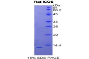 SDS-PAGE analysis of Rat ICOS Protein. (ICOS 蛋白)