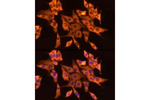 Immunofluorescence analysis of PC-12 cells using GSDMD Rabbit pAb  at dilution of 1:200 (40x lens). (GSDMD 抗体)