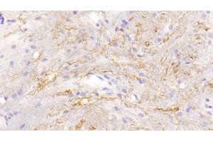 Detection of CTSG in Mouse Spinal cord Tissue using Polyclonal Antibody to Cathepsin G (CTSG) (Cathepsin G 抗体  (AA 21-261))