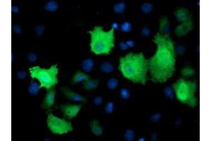 Anti-TMOD1 mouse monoclonal antibody (ABIN2454776) immunofluorescent staining of COS7 cells transiently transfected by pCMV6-ENTRY TMOD1 (RC201134). (Tropomodulin 1 抗体)