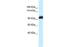 WB Suggested Anti-Zhx1 Antibody   Titration: 1. (ZHX1 抗体  (C-Term))