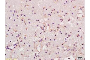 Formalin-fixed and paraffin embedded rat brain labeled with Anti-Glypican 6 Polyclonal Antibody, Unconjugated (ABIN678368) at 1:200 followed by conjugation to the secondary antibody and DAB staining (Glypican 6 抗体  (AA 351-450))