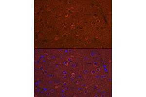 Immunofluorescence analysis of Mouse brain using DC/DCLK1 antibody (ABIN6134321, ABIN6139438 and ABIN7101849) at dilution of 1:100 (40x lens). (DCLK1 抗体)