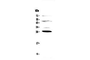 Western blot analysis of Factor D using anti-Factor D antibody . (Adipsin 抗体  (AA 26-253))
