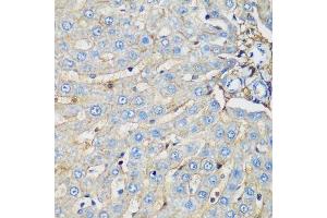 Immunohistochemistry of paraffin-embedded rat liver using PROCR antibody. (PROCR 抗体  (AA 19-209))