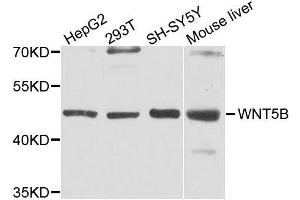 Western blot analysis of extracts of various cell lines, using WNT5B antibody. (WNT5B 抗体  (AA 120-359))
