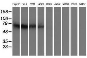 Image no. 4 for anti-Iduronate 2-Sulfatase (IDS) antibody (ABIN1498797)