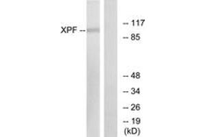 Western Blotting (WB) image for anti-Excision Repair Cross-Complementing Rodent Repair Deficiency, Complementation Group 4 (ERCC4) (AA 801-850) antibody (ABIN2889291) (ERCC4 抗体  (AA 801-850))