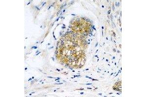 Immunohistochemical analysis of Neuroligin Y staining in human prostate formalin fixed paraffin embedded tissue section. (Neuroligin Y 抗体)