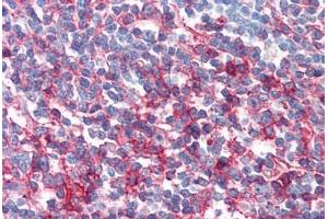 Human Tonsil (formalin-fixed, paraffin-embedded) stained with FAS antibody ABIN351542 at 10 ug/ml followed by biotinylated anti-mouse IgG secondary antibody ABIN481714, alkaline phosphatase-streptavidin and chromogen. (FAS 抗体)