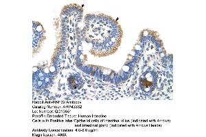 Human Intestine (RNF39 抗体  (N-Term))