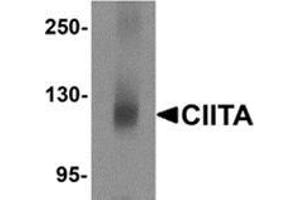 Western blot analysis of CIITA in mouse brain tissue lysate with CIITA antibody at 1 μg/ml. (CIITA 抗体  (N-Term))