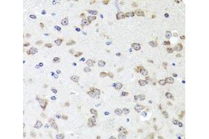 Immunohistochemistry of paraffin-embedded Mouse brain using IGFBP5 Polyclonal Antibody at dilution of 1:100 (40x lens). (IGFBP5 抗体)