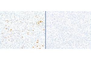 Immunohistochemistry (IHC) image for anti-gamma Histone Variant H2AX (GAMMA-H2AX) (Ser140) antibody (ABIN7449557) (gamma H2AX 抗体  (Ser140))