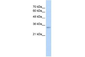WB Suggested Anti-THOC4 Antibody Titration:  2. (THO Complex 4 抗体  (N-Term))