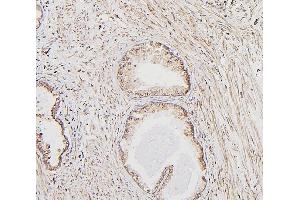IHC analysis of CALR using anti-CALR antibody (ABIN7600329). (Calreticulin 抗体  (AA 18-323))