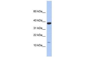 RPL27 antibody used at 1 ug/ml to detect target protein. (RPL27 抗体  (Middle Region))