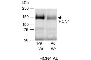 anti-Hyperpolarization Activated Cyclic Nucleotide-Gated Potassium Channel 4 (HCN4) (AA 1019-1108), (C-Term), (Cytosolic) antibody