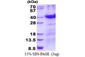 Image no. 1 for Methyl-CpG Binding Domain Protein 3 (MBD3) protein (His tag) (ABIN1098411) (MBD3 Protein (His tag))