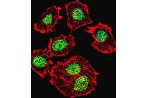 Fluorescent confocal image of  cell stained with p53 Antibody  h. (p53 抗体  (AA 293-322))