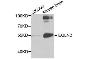 Western blot analysis of extracts of various cell lines, using EGLN2 antibody. (PHD1 抗体  (AA 150-250))